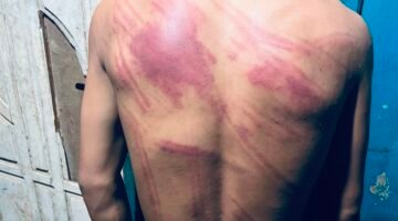 Prof. Sutan Nasomal Minta Kapolda Sultra Perintahkan Kapolres Kolaka Usut Transparan Dugaan Penganiayaan di Lingkungan PT MPP